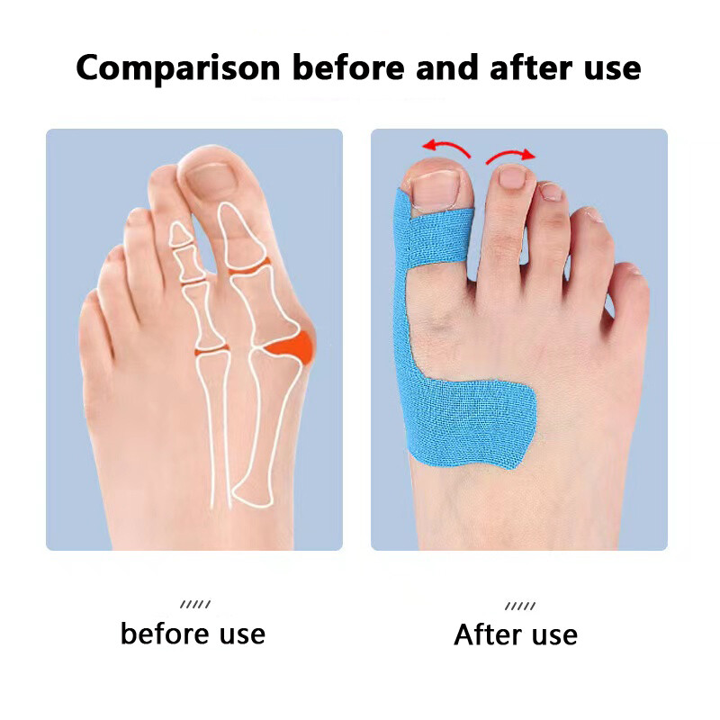 10 бр. Hallux Valgus Фиксирана опора Спортна еластична превръзка на пръстите на краката Антифрикционна защитна лента Patch Унисекс Инструменти за грижа за краката