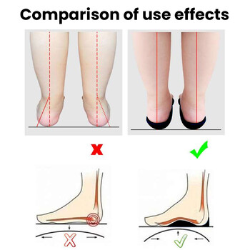 Ортопедични стелки Ортопеди Плоско стъпало Здраве Подметка за обувки Вложка Поддържаща подложка за дъга За грижа за краката Стелки Унисекс 1 чифт