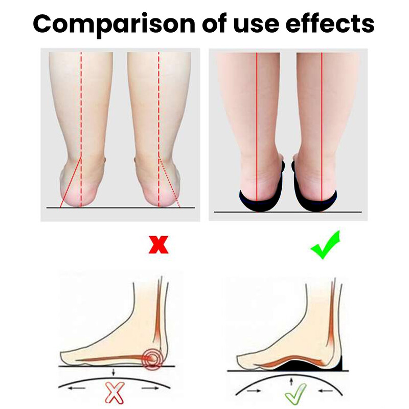 Ortopedski ulošci Ortotika Zdravlje ravnih stopala Jastučić za potplate Za cipele Uložak za potporu luka Za njegu stopala Ulošci Unisex 1 par