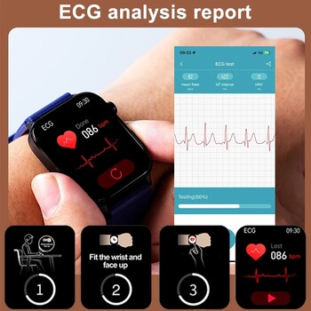 2024 Νέο Έξυπνο ρολόι ECG+PPG Ιατρικού βαθμού ανδρικό ρολόι γλυκόζης αίματος Παρακολούθηση λιπιδίων ουρικού οξέος Bluetooth Call Health Smartwatches