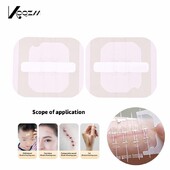 2/3 tk tõmblukuga sideme haava sulgemise plaaster Hemostaatiline plaaster haava kiirõmblus tõmblukuga, kaasaskantav välistingimustes