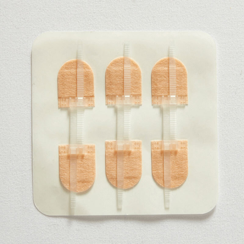 3 vnt. Užtrauktuku surišamas žaizdos uždarymo pleistras Hemostatinis pleistras, greitai susiuvami užtrauktuko juostos pagalba lauke, nešiojama odos priežiūra