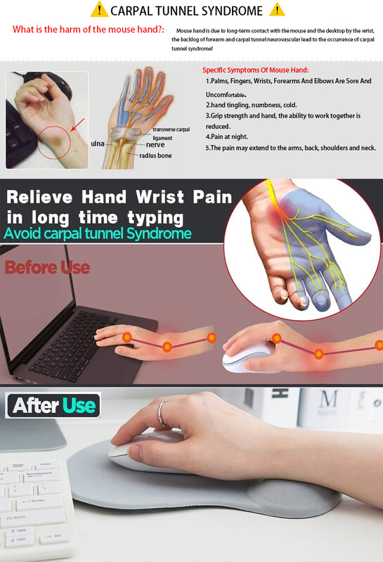 Slatka podloga za podršku od silika gela za zaštitu za zapešće može se slobodno pomicati Podloga za uredsku zaštitnu podlogu za miš Ergonomska podloga za miš za naslon za zapešće za prijenosno računalo