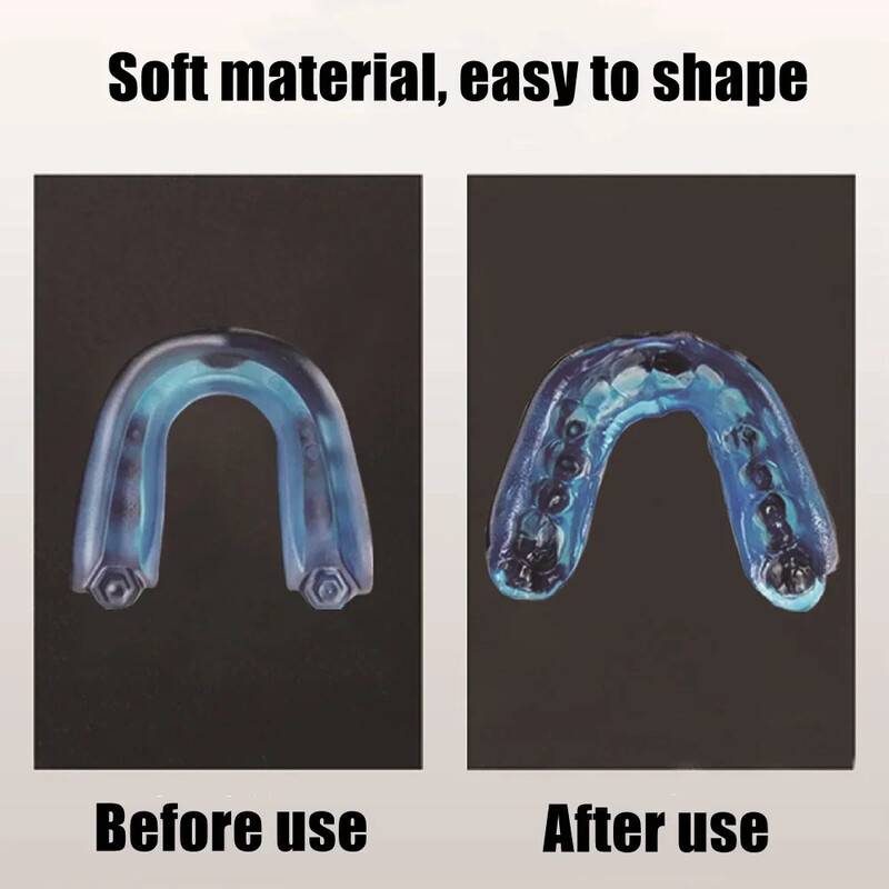 1 set Protecție bucală pentru sport profesională, armură pentru dinți pentru a proteja bretele pentru adulți, protecție moale pentru gură, protecție anti-sforăit pentru box