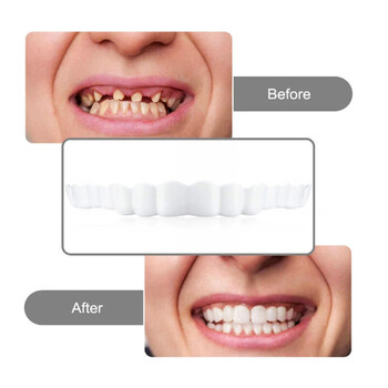 2 ζεύγη Smile Whitening Teeth Snap Cap οδοντοστοιχία Φροντίδα λεύκανσης Εναλλακτικά Smile Snap Tooth Τέλεια ψεύτικα δόντια για άνδρες και γυναίκες