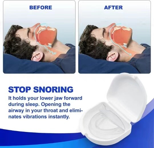 1 buc anti sforăit Stop Grinding Piesa bucală anti sforăit apărător pentru gură Modelare personalizată și ajustare reglabilă cu carcasă de depozitare