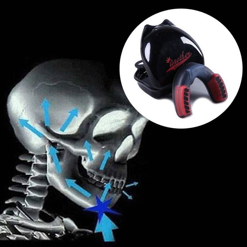 1vnt vaikų / suaugusiųjų bokso dantenų skydas, burnos apsauga MMA regbio krepšinio futbolo futbolo kandiklis lūpų dantų breketai su laikymo dėžute