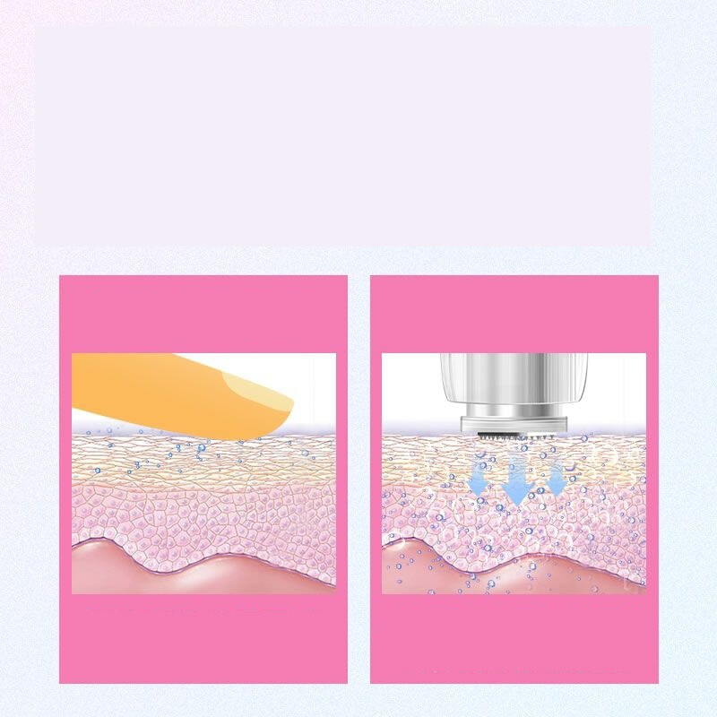 Συσκευή μικροβελόνων Qianshuitang, ηλεκτρικό λεωφορείο, στυλό, βελόνα, φως νερού, λυοφιλοποιημένη σκόνη mts, μεσόδερμα, νανομικροκρυσταλλική εισαγωγή