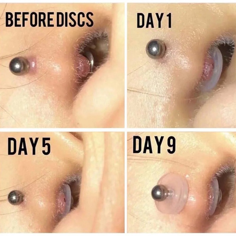 10-100 kom Nakit za piercing Meka brtva Silikonski diskovi za zacjeljivanje piercinga Fleksibilni protiv hiperplazije Fiksirane naušnice Prsten za nos i usne