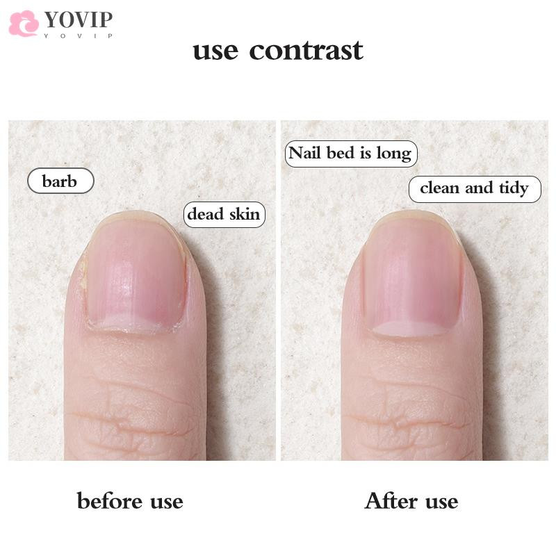 1 gab. Divu galviņu kutikulas trimmeris stūmējs kutikulas naža noņemšanai atmirušās ādas noņemšanai V-veida dakšas manikīra pedikīra nagu mākslas rīks
