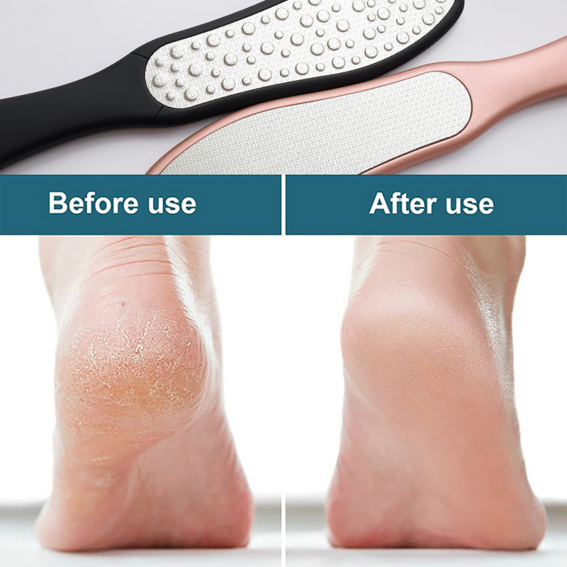 Pēdu vīle abpusēja pēdu rasp callus kukurūzas noņemšanas līdzeklis saplaisājušiem papēžiem, nerūsējošā tērauda profesionālie pēdu kopšanas pedikīra instrumenti