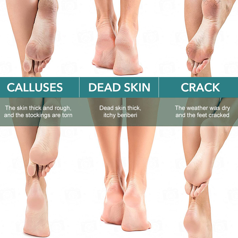 1PC nanostikla pēdas rasp papēža vīle Hard Dead Skin Callus Remover Pīlinga pedikīra kopšanas rīks Izturīgs pēdu vīles rīks