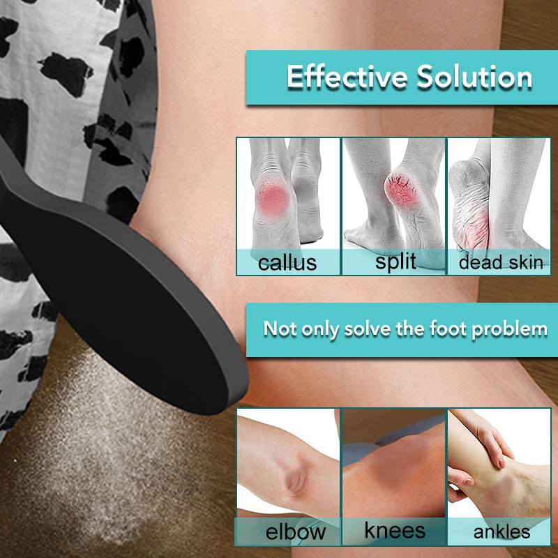 1PC nanostikla pēdas rasp papēža vīle Hard Dead Skin Callus Remover Pīlinga pedikīra kopšanas rīks Izturīgs pēdu vīles rīks