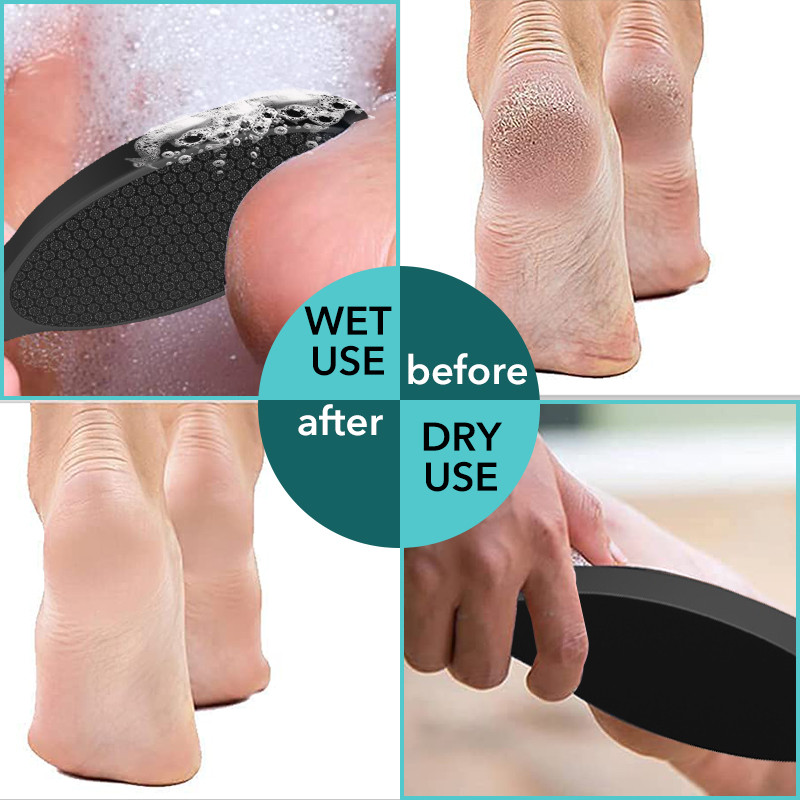 1PC nanostikla pēdas rasp papēža vīle Hard Dead Skin Callus Remover Pīlinga pedikīra kopšanas rīks Izturīgs pēdu vīles rīks