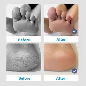 Απολέπιση ποδιών λαβή πεντικιούρ ελαφρόπετρα Ξύστρα λίμα ποδιών Dead Hard Rough Rough Skin Scrub Scrub Callus Remover Εγχειρίδιο ραγισμένες φτέρνες