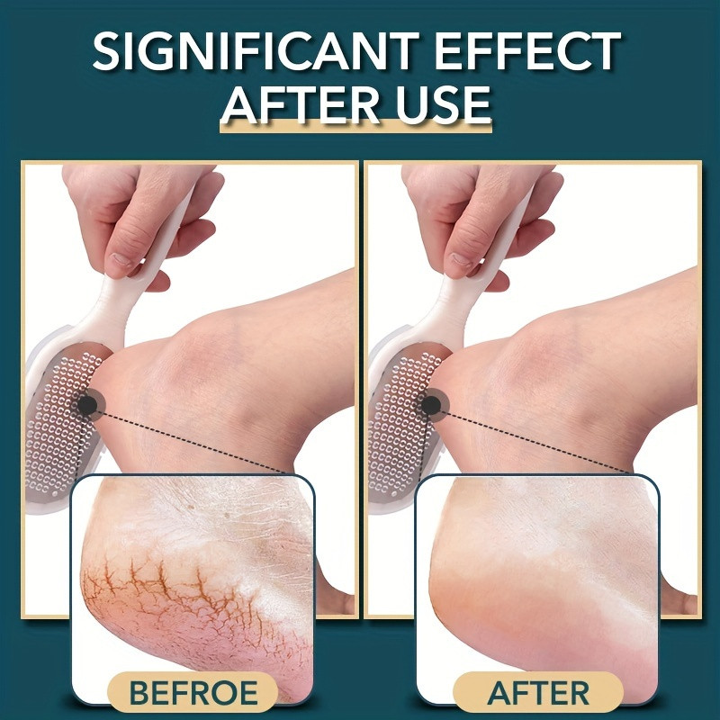 1 darabos Foot Rasp lábreszelő és bőrkeményedés eltávolító, a legjobb lábápoló pedikűr fémfelületi eszköz a kemény bőr eltávolítására, használható B felületen