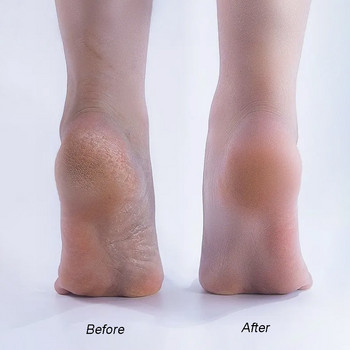 Φορητό Foot File Callus Remover Mini Foot Rasp Επαγγελματικό Scrubber Pedicure Remove Hard Skin για υγρά και ξηρά πόδια
