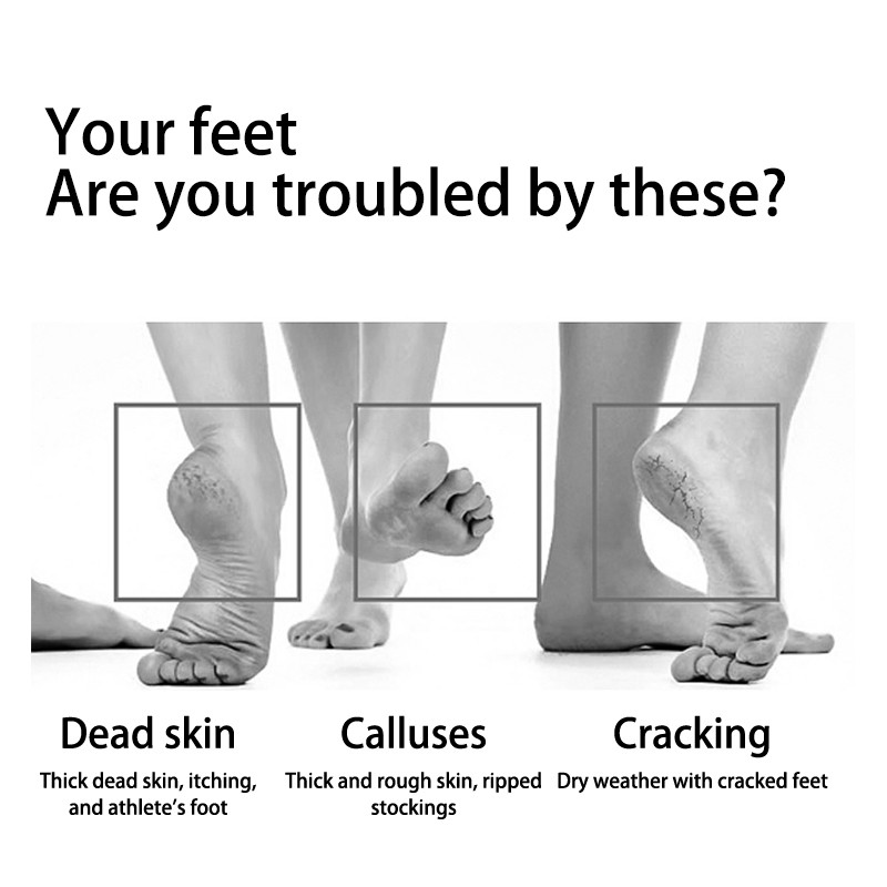 1 tk Kooriv jalgade pediküüri käepide PU pimsskivist kaabits jalaviil Dead Hard Rough Kuiva naha koorija kalluse eemaldaja